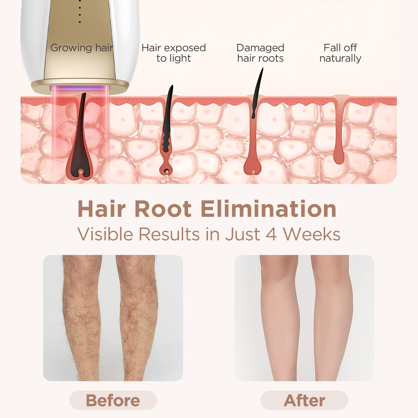 IPL Hair Removal Device-D-T018